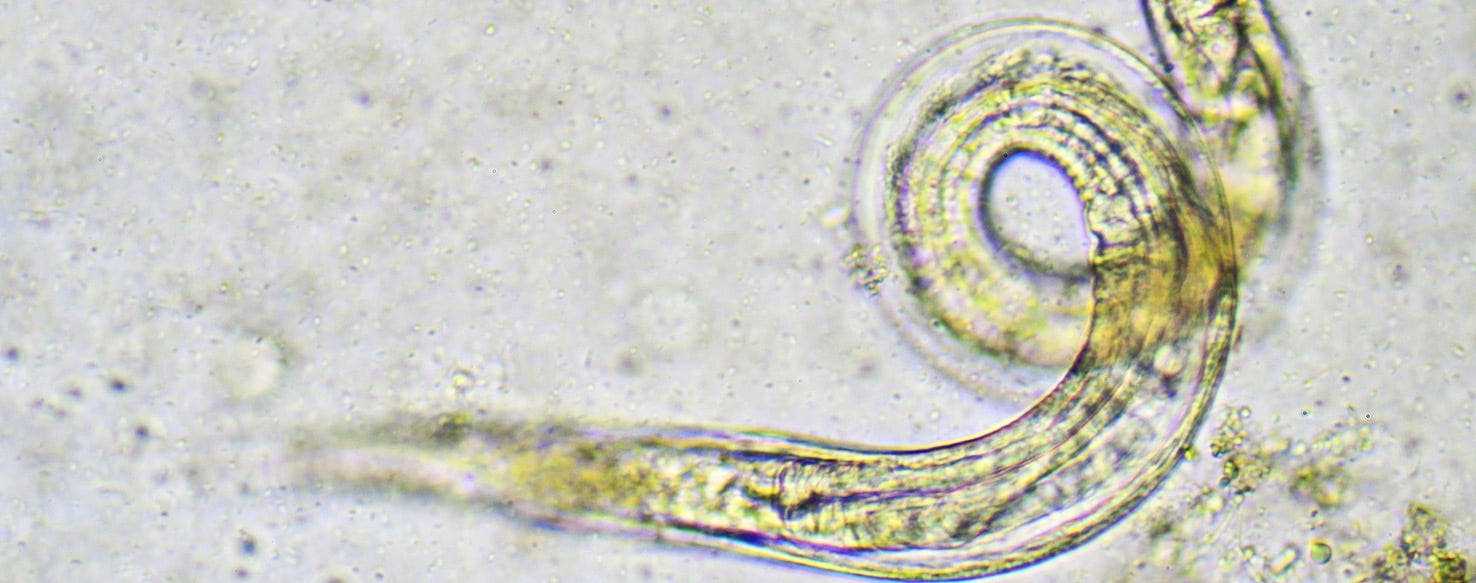 Preventive Measures for Pinworm Infection