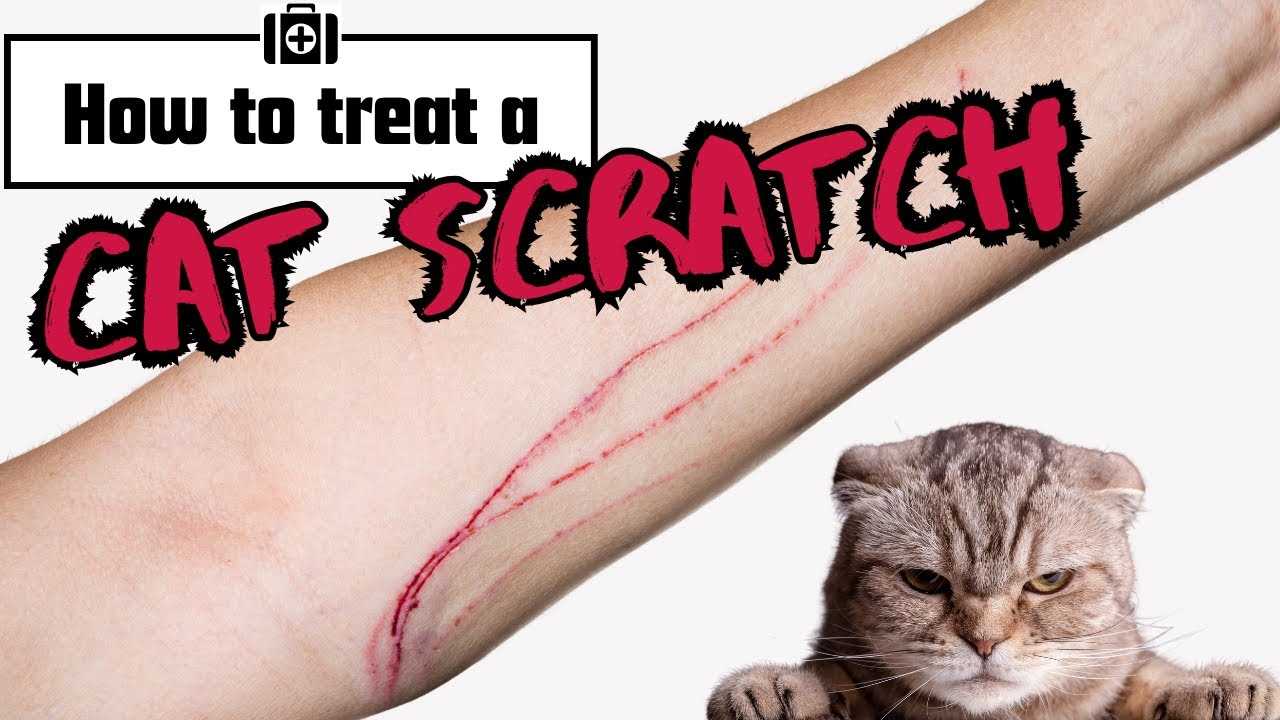 Monitoring for Signs of Infection
