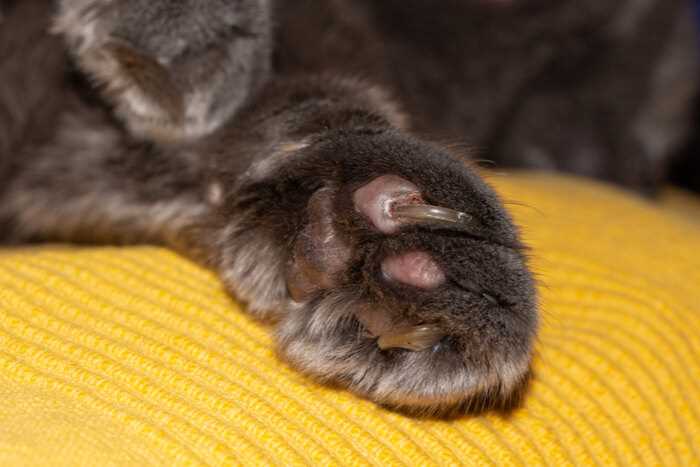 Assessing the Health Implications of Nail Chewing