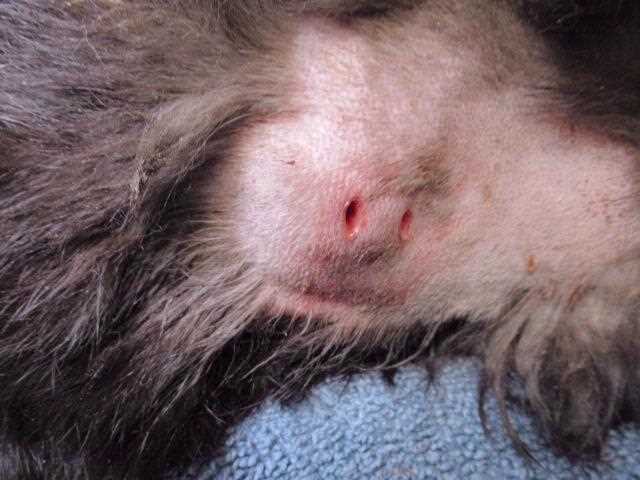 Preventive Measures to Reduce Abscess Risk